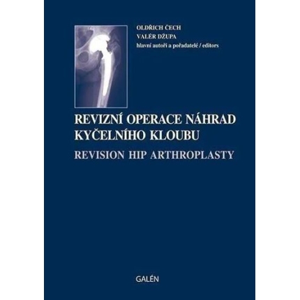 revizni-operace-nahrad-kycelniho-kloubu oldrich cech