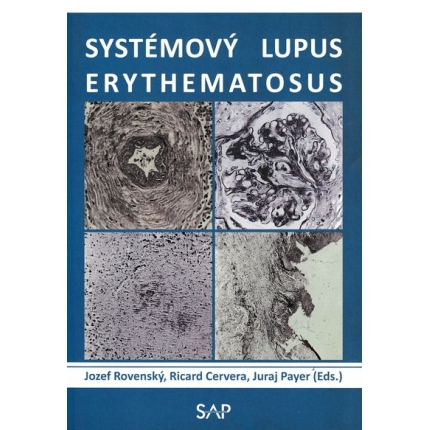 Systémový lupus erythematosus rovensky cervera payer