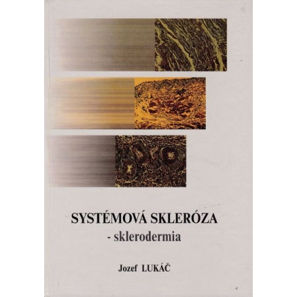 systemova skleroza sklerodermia jozef lukac