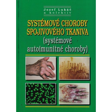 systemove choroby spojivoveho tkaniva jozef lukac