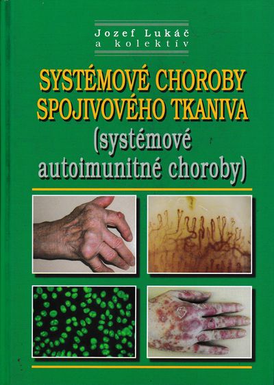 systemove choroby spojivoveho tkaniva jozef lukac systemove choroby spojivoveho tkaniva jozef lukac